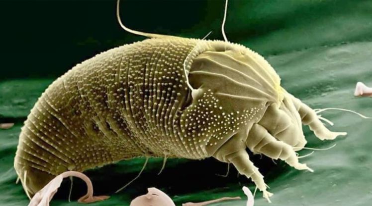 La gale des&nbsp;pattes